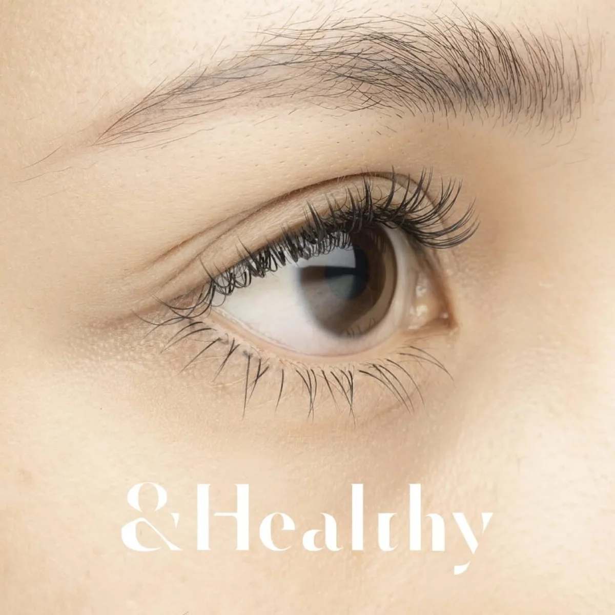 アンドヘルシー施術後の美しい目元